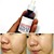 serum-tai-tao-red-peel-tingle-serum-4.jpg 4